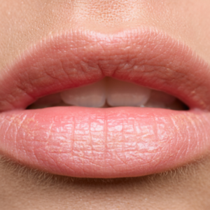Lip Flip