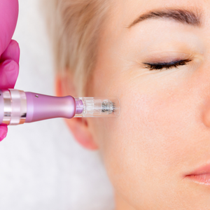 Microneedling with PRP/PRF 4 pack